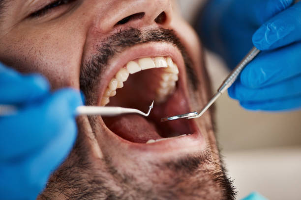 Best Emergency Treatment for Dental Infections or Abscesses in Gosnell, AR